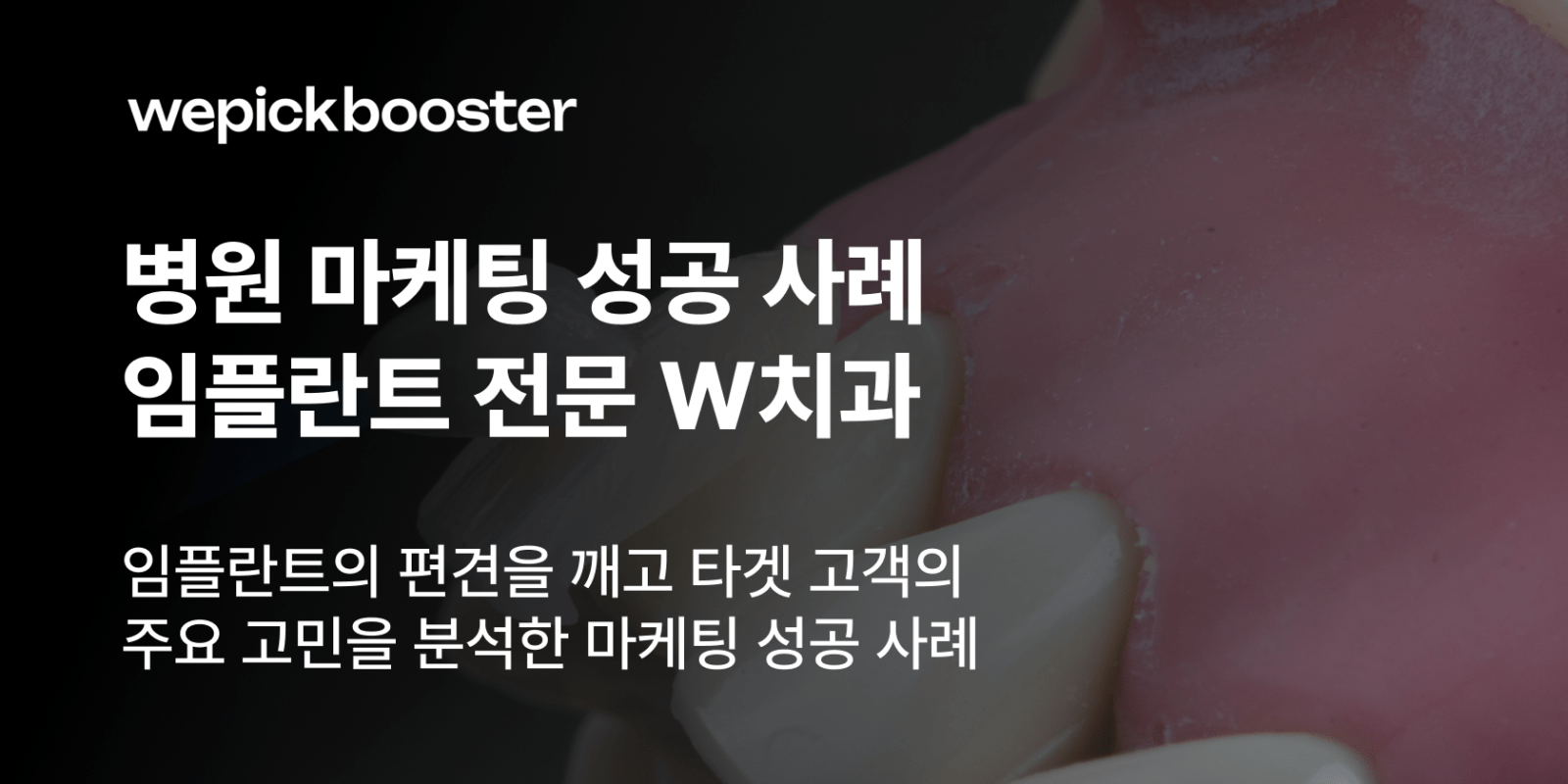 한국 치과 클리닉을 위한 SNS 마케팅 전략 개요