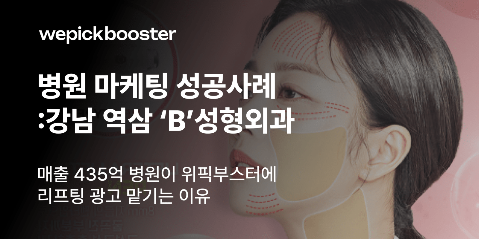 병원 마케팅 성공사례: 강남 역삼 ‘B’성형외과 썸네일